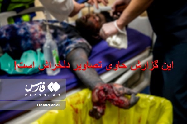 مصدومان چهارشنبه سوزی!