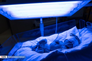 قل پنجم (  قل E  ) در بخش  مراقبت های ویژه نوزادان (  NICU 4 ) زیر دستگاه فتوتراپی جهت درمان زردی / بیمارستان حضرت زینب(س) شیراز