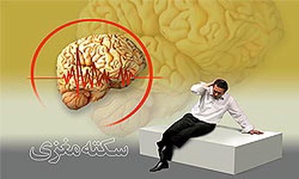 طرح سکته مغزی