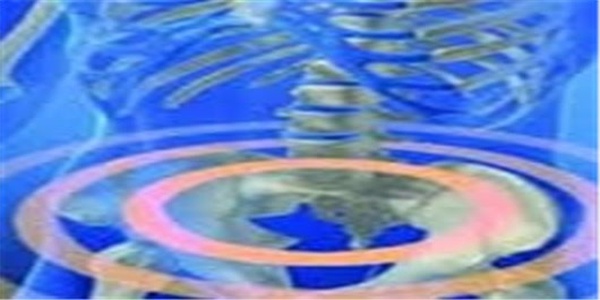 آندومتریوز
