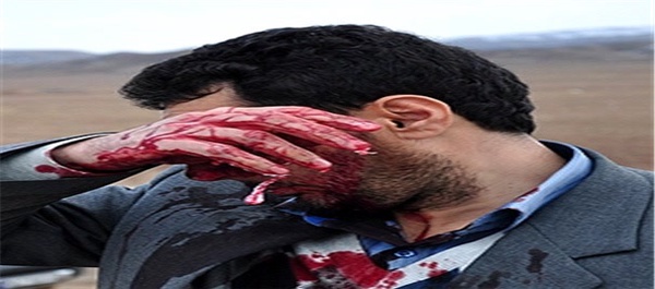 تصادف در جاده اهر به تبریز