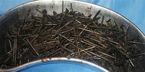 میخ