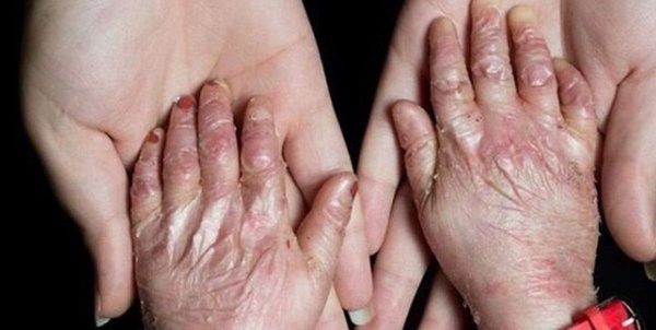پروانه ای