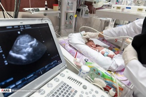 دکتر بخش مراقبت های ویژه نوزادان ( NICU 4 ) از سر یا مغز قل پنجم (  قل E  )  سونوگرافی می گیرد./ بیمارستان حضرت زینب(س) شیراز
