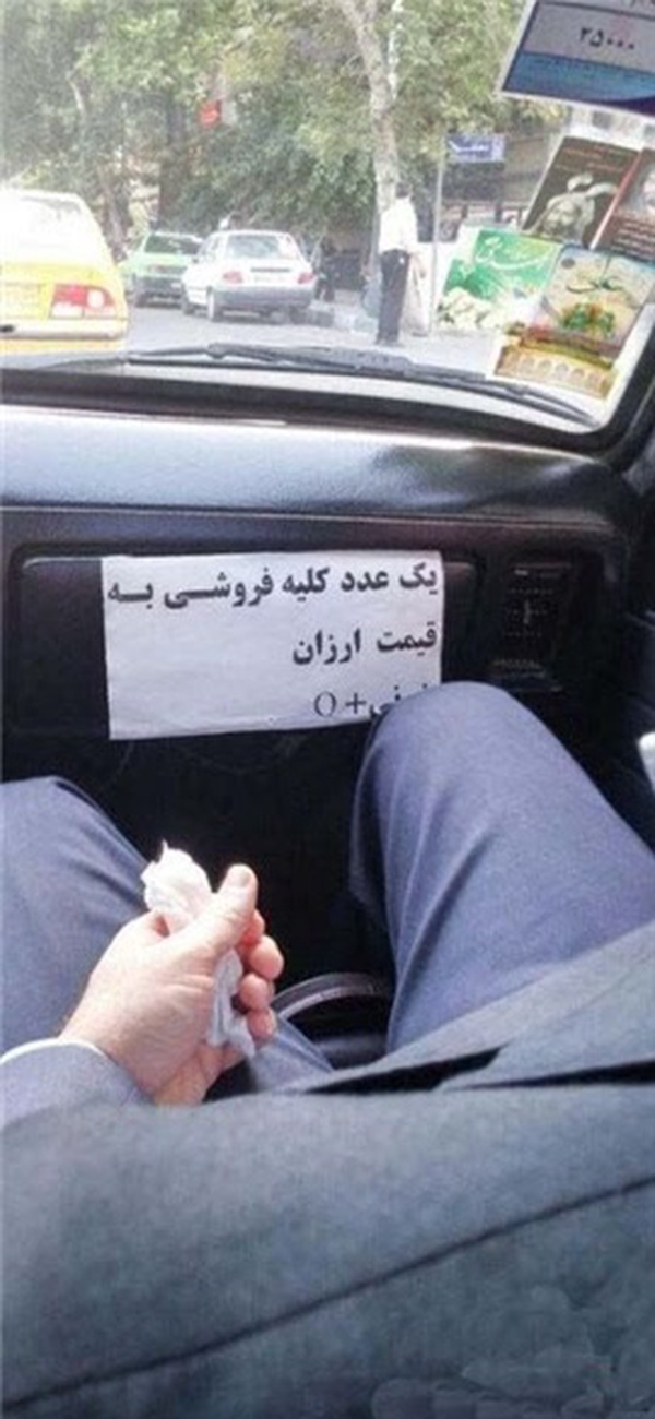 فروش کلیه