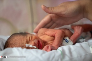 قل دوم (  قل B  ) / بخش مراقبت های ویژه نوزادان ( NICU 3 ) بیمارستان حضرت زینب(س) شیراز