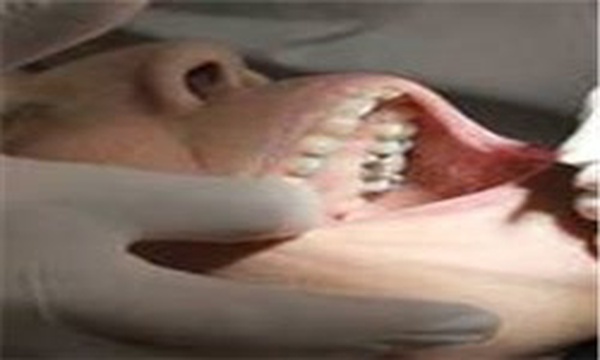 دندان