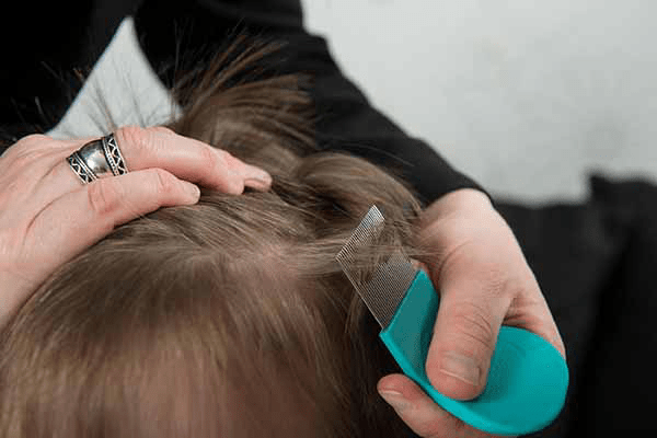 دانش‌آموزان چگونه از ابتلا به شپش سر پیشگیری کنند