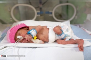 قل یکم (  قل A  ) دختر / بخش مراقبت های ویژه نوزادان ( NICU 1 ) بیمارستان حضرت زینب(س) شیراز