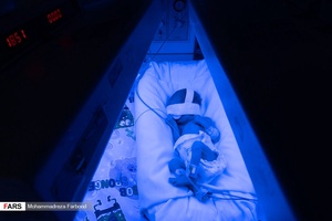 قل پنجم (  قل E  ) در بخش  مراقبت های ویژه نوزادان ( NICU 4 ) زیر دستگاه فتوتراپی جهت درمان زردی / بیمارستان حضرت زینب(س) شیراز